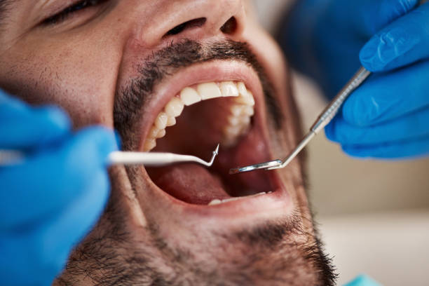 Best Walk-In Emergency Dentist in Crosby, TX